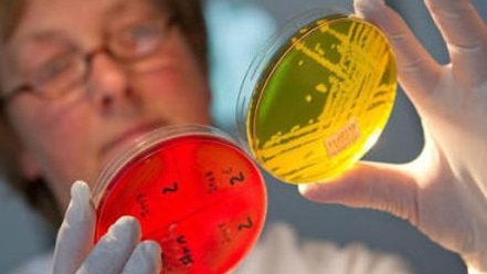 Staphylococcus aureus diagnózis