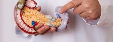 Hasnyálmirigy-gyulladás kezelése