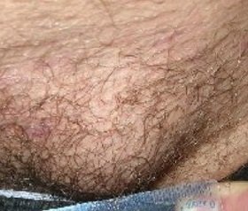 Lágyéksérv a férfiak